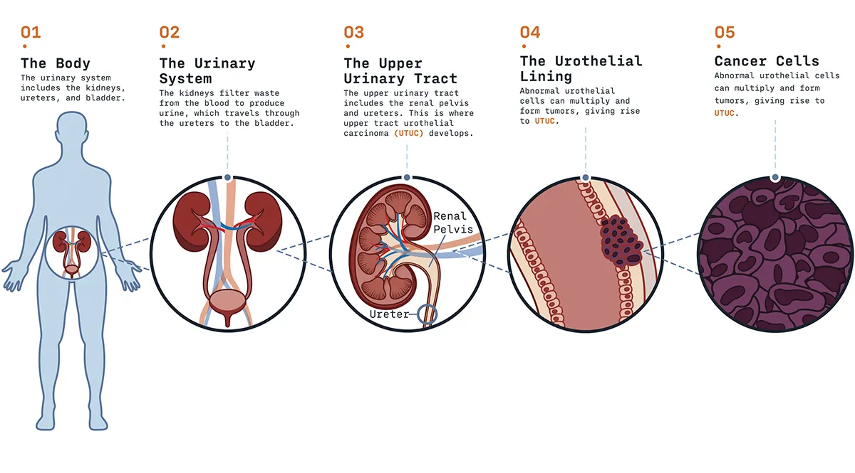 fpo illustration showing utuc diagram
